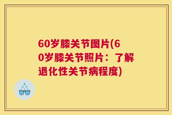 60岁膝关节图片(60岁膝关节照片:了解退化性关节程度) 60岁膝关节图片(60岁膝关节照片:了解退化性关节程度)