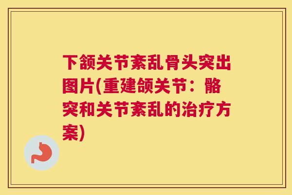 下颔关节紊乱骨头突出图片(重建颌关节：骼突和关节紊乱的方案)