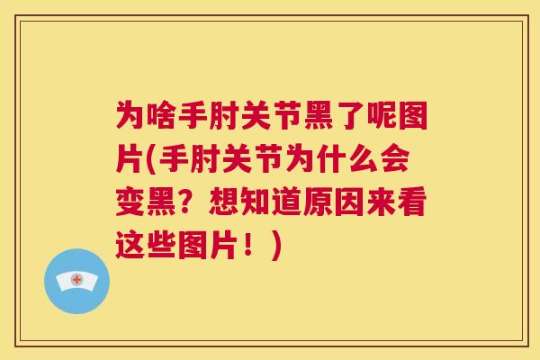 为啥手肘关节黑了呢图片(手肘关节为什么会变黑？想知道原因来看这些图片！)