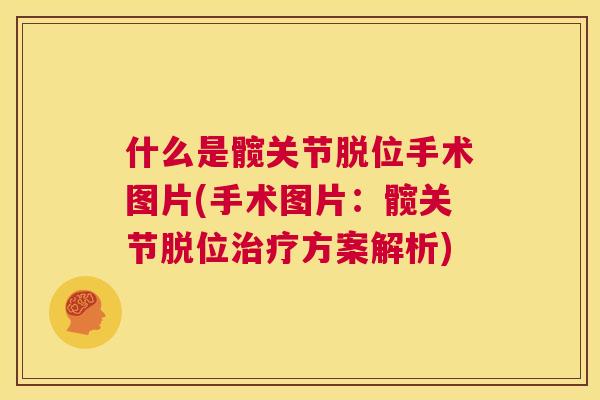 什么是髋关节脱位手术图片(手术图片:髋关节脱位治疗方案解析)