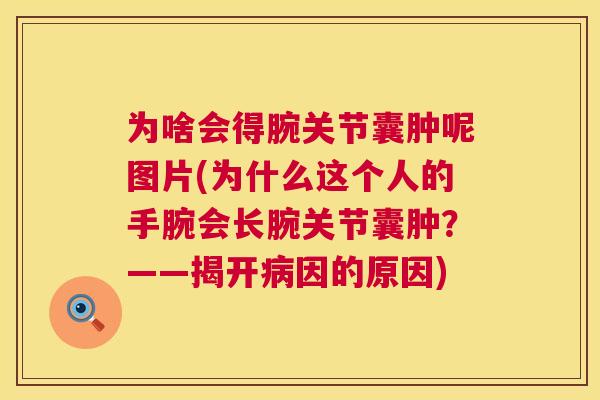 为啥会得腕关节囊肿呢图片(为什么这个人的手腕会长腕关节囊肿?——揭开病因的原因)