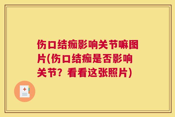 伤口结痂影响关节嘛图片(伤口结痂是否影响关节?看看这张照片)