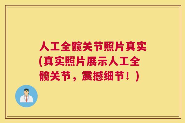 人工全髋关节照片真实(真实照片展示人工全髋关节,震撼细节!)