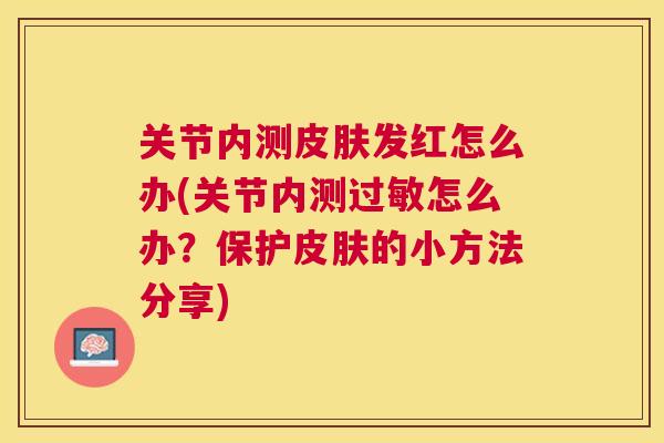 关节内测发红怎么办(关节内测怎么办？保护的小方法分享)