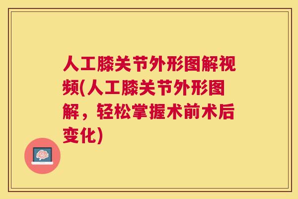 人工膝关节外形图解视频(人工膝关节外形图解，轻松掌握术前术后变化)