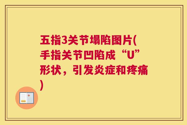 五指3关节塌陷图片(手指关节凹陷成“U”形状，引发炎症和疼痛)