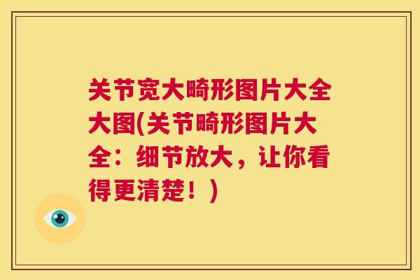 关节宽大畸形图片大全大图(关节畸形图片大全:细节放大,让你看得更清楚!) 关节宽大畸形图片大全大图(关节畸形图片大全:细节放大,让你看得更清楚!)