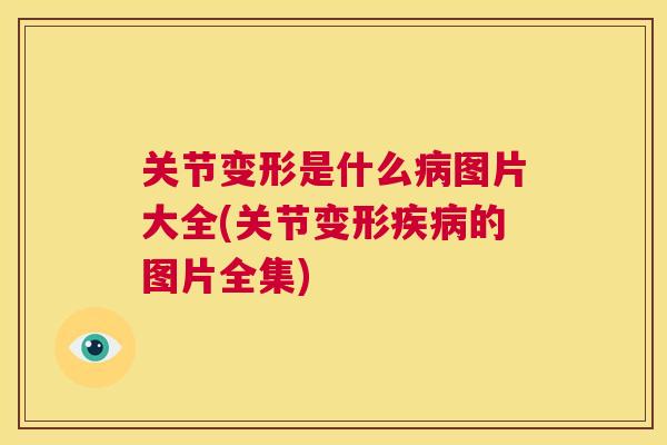 关节变形是什么图片大全(关节变形的图片全集) 关节变形是什么图片大全(关节变形的图片全集)