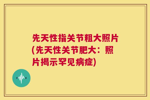 先天性指关节粗大照片(先天性关节肥大：照片揭示罕见症)