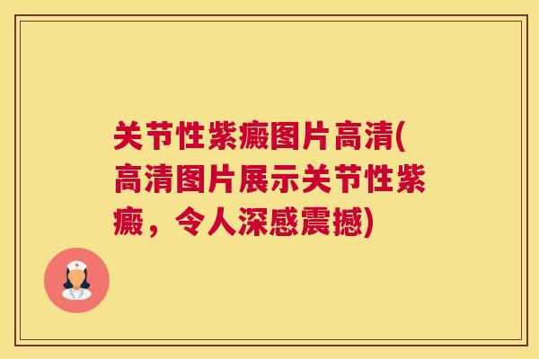关节性紫癜图片高清(高清图片展示关节性紫癜,令人深感震撼)