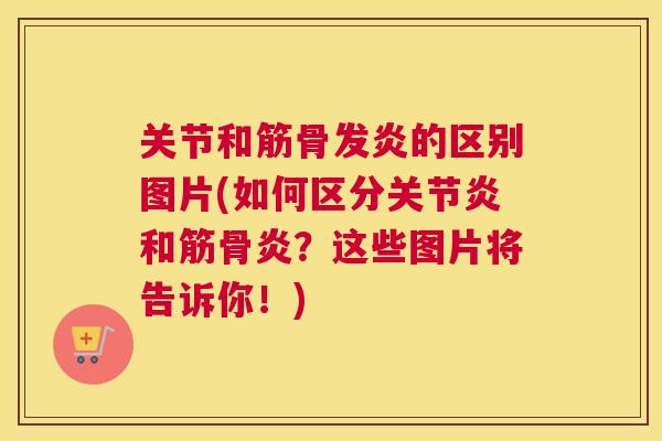 关节和筋骨发炎的区别图片(如何区分关节炎和筋骨炎?这些图片将告诉你!)