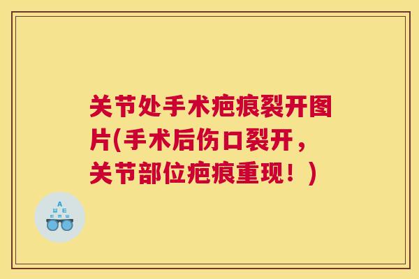 关节处手术疤痕裂开图片(手术后伤口裂开,关节部位疤痕重现!)
