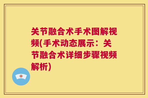 关节融合术手术图解视频(手术动态展示：关节融合术详细步骤视频解析)