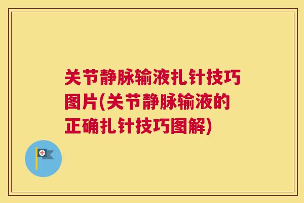关节静脉输液扎针技巧图片(关节静脉输液的正确扎针技巧图解) 关节静脉输液扎针技巧图片(关节静脉输液的正确扎针技巧图解)