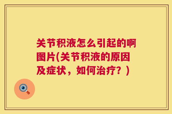 关节积液怎么引起的啊图片(关节积液的原因及症状,如何?) 关节积液怎么引起的啊图片(关节积液的原因及症状,如何?)