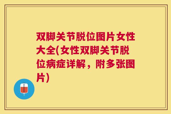 双脚关节脱位图片女性大全(女性双脚关节脱位病症详解,附多张图片)