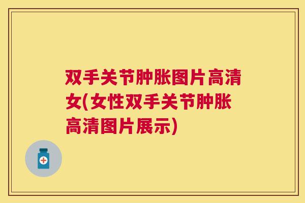 双手关节肿胀图片高清女(女性双手关节肿胀高清图片展示)