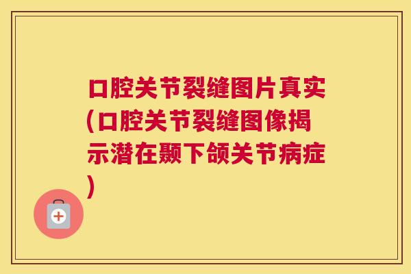 口腔关节裂缝图片真实(口腔关节裂缝图像揭示潜在颞下颌关节症)