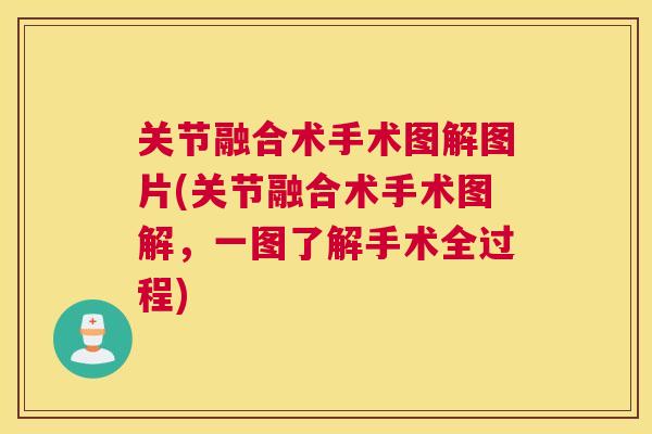 关节融合术手术图解图片(关节融合术手术图解,一图了解手术全过程) 关节融合术手术图解图片(关节融合术手术图解,一图了解手术全过程)