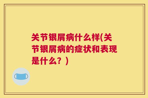 关节银屑病什么样(关节银屑病的症状和表现是什么?)
