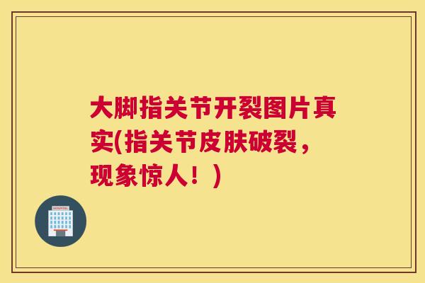 大脚指关节开裂图片真实(指关节皮肤破裂,现象惊人!)