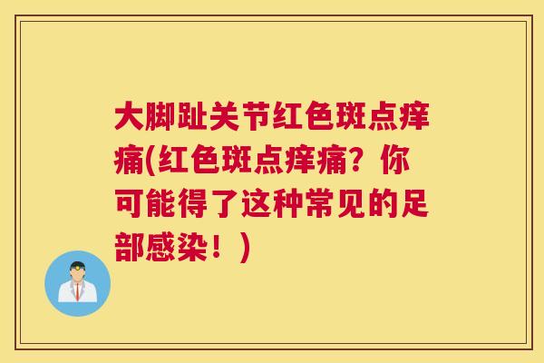 大脚趾关节红色斑点痒痛(红色斑点痒痛?你可能得了这种常见的足部!) 大脚趾关节红色斑点痒痛(红色斑点痒痛?你可能得了这种常见的足部!)