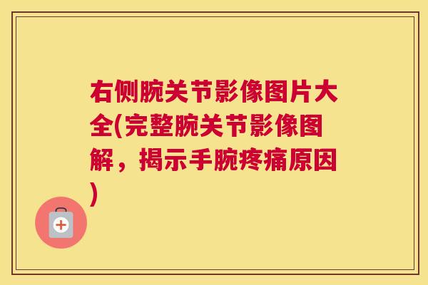 右侧腕关节影像图片大全(完整腕关节影像图解,揭示手腕原因) 右侧腕关节影像图片大全(完整腕关节影像图解,揭示手腕原因)