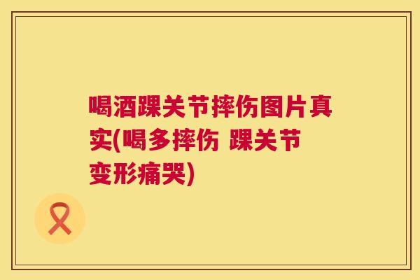喝酒踝关节摔伤图片真实(喝多摔伤 踝关节变形痛哭)