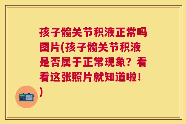 孩子髋关节积液正常吗图片(孩子髋关节积液是否属于正常现象?看看这张照片就知道啦!)
