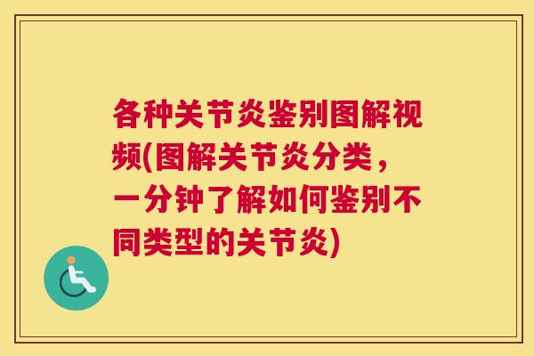 各种鉴别图解视频(图解分类,一分钟了解如何鉴别不同类型的) 各种鉴别图解视频(图解分类,一分钟了解如何鉴别不同类型的)