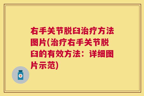 右手关节脱臼方法图片(右手关节脱臼的有效方法：详细图片示范)