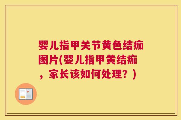 婴儿指甲关节黄色结痂图片(婴儿指甲黄结痂,家长该如何处理?)