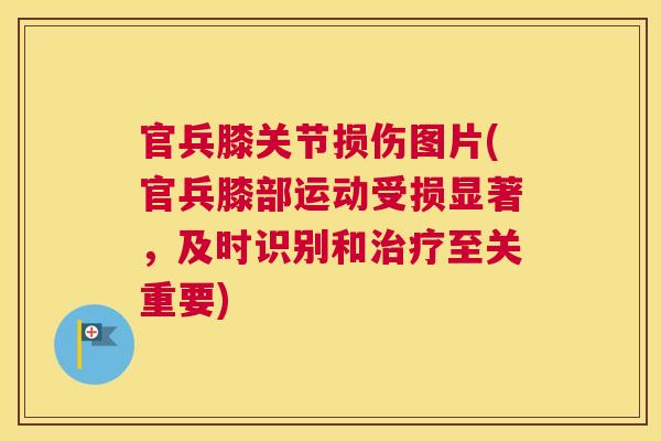 官兵膝关节损伤图片(官兵膝部运动受损显著,及时识别和至关重要) 官兵膝关节损伤图片(官兵膝部运动受损显著,及时识别和至关重要)