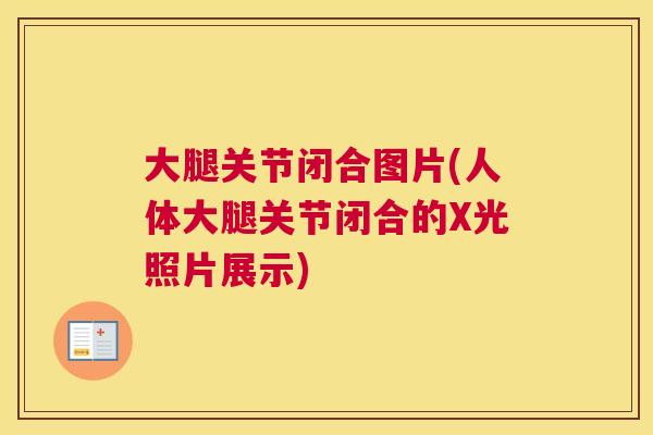 大腿关节闭合图片(人体大腿关节闭合的X光照片展示)