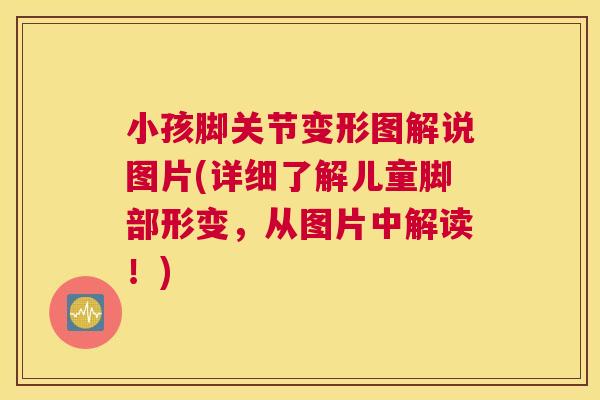小孩脚关节变形图解说图片(详细了解儿童脚部形变,从图片中解读!)