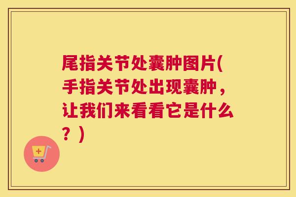 尾指关节处囊肿图片(手指关节处出现囊肿,让我们来看看它是什么?) 尾指关节处囊肿图片(手指关节处出现囊肿,让我们来看看它是什么?)
