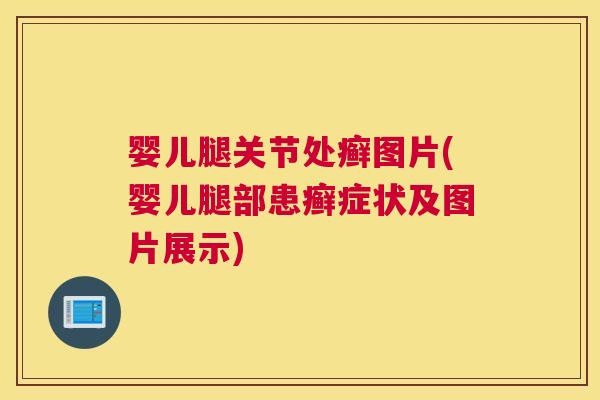 婴儿腿关节处癣图片(婴儿腿部患癣症状及图片展示)