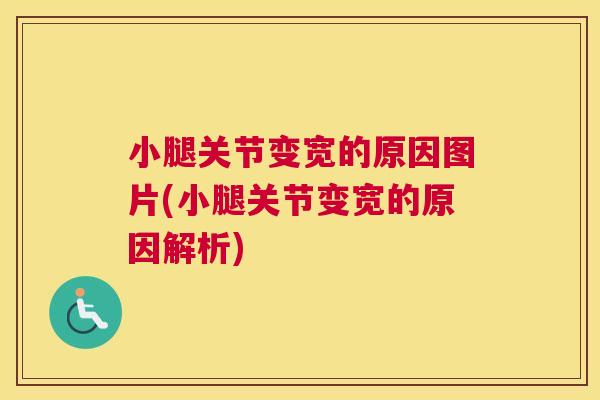 小腿关节变宽的原因图片(小腿关节变宽的原因解析) 小腿关节变宽的原因图片(小腿关节变宽的原因解析)