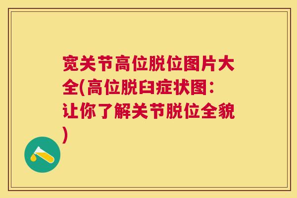 宽关节高位脱位图片大全(高位脱臼症状图：让你了解关节脱位全貌)