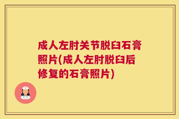 成人左肘关节脱臼石膏照片(成人左肘脱臼后修复的石膏照片) 成人左肘关节脱臼石膏照片(成人左肘脱臼后修复的石膏照片)