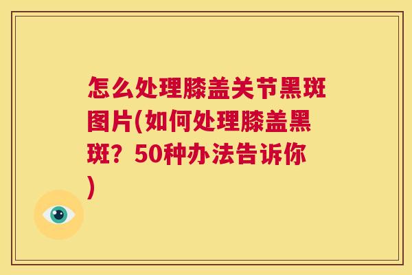 怎么处理膝盖关节黑斑图片(如何处理膝盖黑斑?50种办法告诉你) 怎么处理膝盖关节黑斑图片(如何处理膝盖黑斑?50种办法告诉你)