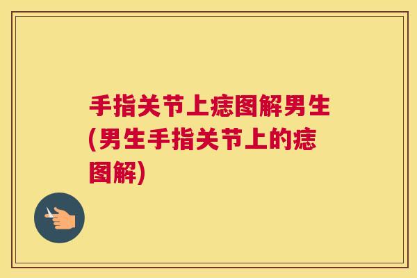 手指关节上痣图解男生(男生手指关节上的痣图解) 手指关节上痣图解男生(男生手指关节上的痣图解)