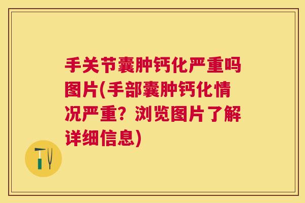 手关节囊肿钙化严重吗图片(手部囊肿钙化情况严重?浏览图片了解详细信息) 手关节囊肿钙化严重吗图片(手部囊肿钙化情况严重?浏览图片了解详细信息)