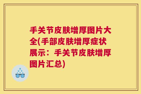 手关节皮肤增厚图片大全(手部皮肤增厚症状展示:手关节皮肤增厚图片汇总)