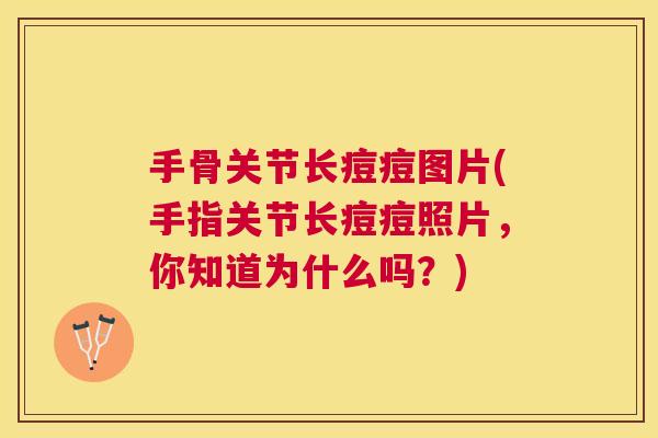 手骨关节长痘痘图片(手指关节长痘痘照片，你知道为什么吗？)