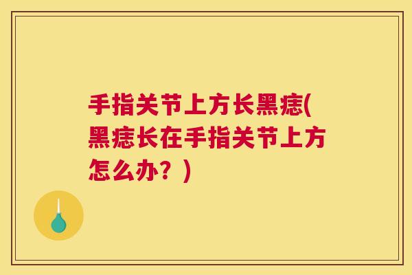 手指关节上方长黑痣(黑痣长在手指关节上方怎么办?) 手指关节上方长黑痣(黑痣长在手指关节上方怎么办?)