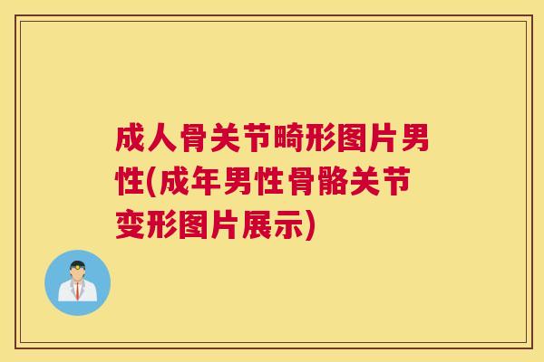 成人骨关节畸形图片男性(成年男性骨骼关节变形图片展示)