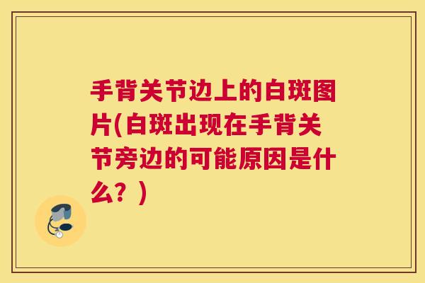 手背关节边上的白斑图片(白斑出现在手背关节旁边的可能原因是什么?)