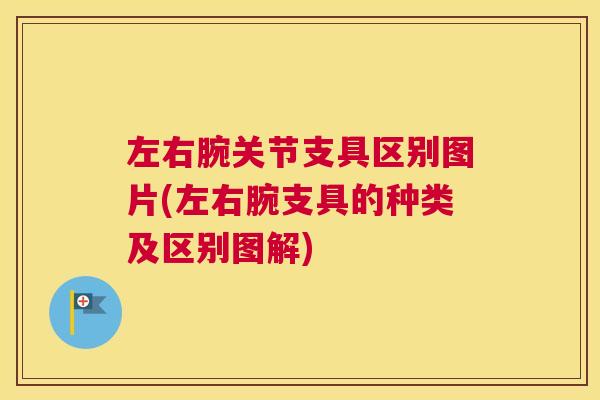 左右腕关节支具区别图片(左右腕支具的种类及区别图解) 左右腕关节支具区别图片(左右腕支具的种类及区别图解)