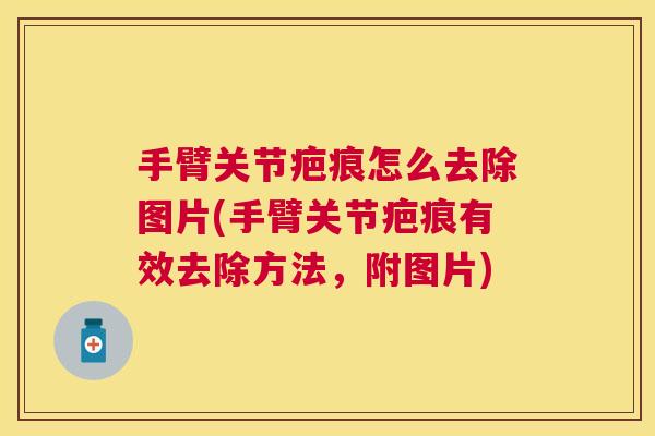 手臂关节疤痕怎么去除图片(手臂关节疤痕有效去除方法,附图片)